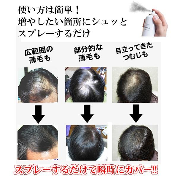 超耐水増毛スプレー Qzジェントリー180ml 薄毛隠し 円形脱毛症 隠す 増毛ふりかけやかつらとは異なる増毛方法 Mqz 02 リアンドゥ 通販 Yahoo ショッピング