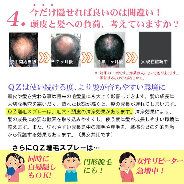 超耐水増毛スプレー 増毛剤「QZジェントリー180ml」【薄毛隠し 円形