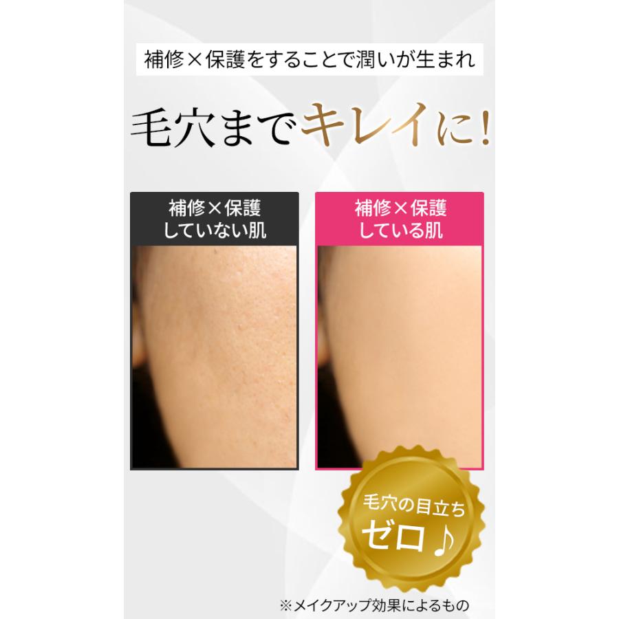 ReBion（リビオン） 化粧水 ヒト幹細胞培養液 エクソソーム ハリ ツヤ