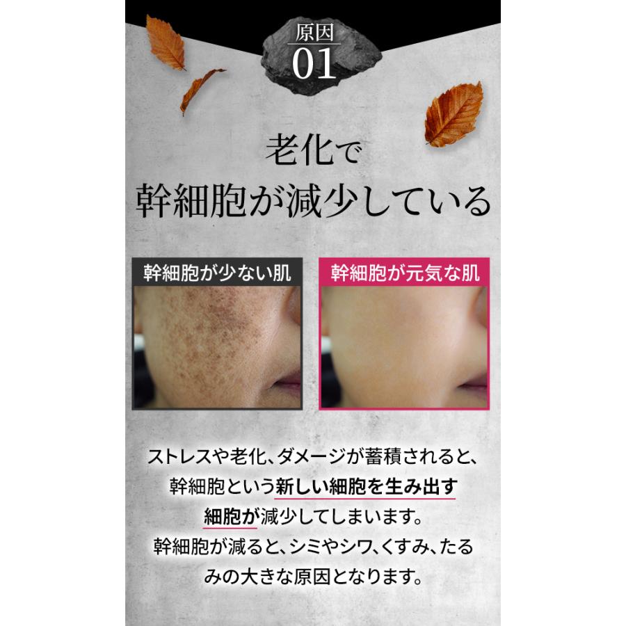 ReBion（リビオン） 化粧水 ヒト幹細胞培養液 エクソソーム ハリ ツヤ