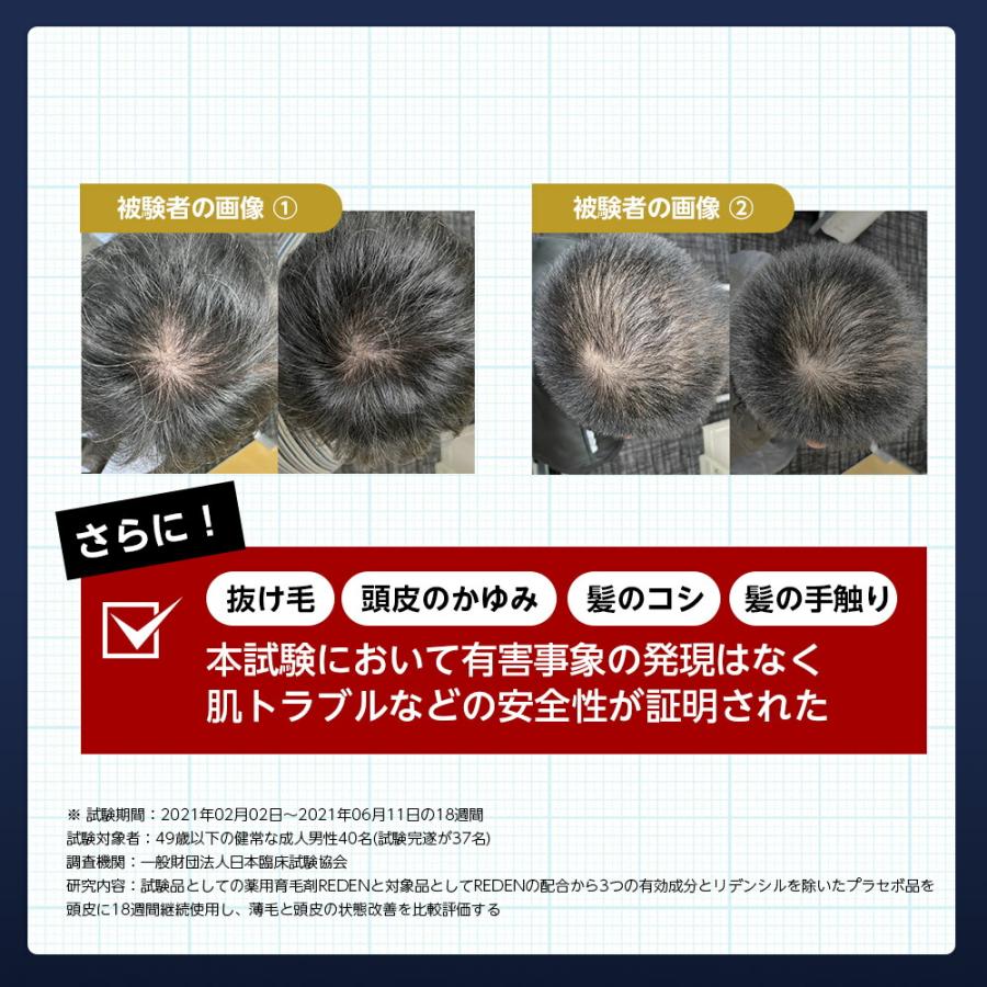REDEN 育毛剤 リデン 3本セット スカルプケア リデンシル 薬用 REDEN 育毛剤 リデン 3本セット スカルプケア リデンシル 薬用