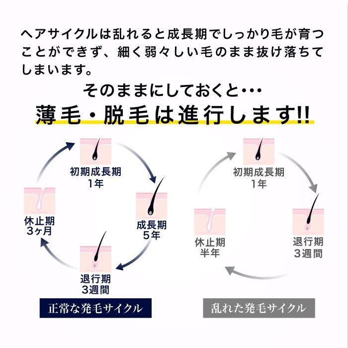 育毛剤 REDEN リデン スカルプケア リデンシル 薬用育毛剤 医薬部外品 育毛 抜け毛 予防 ボリュームアップ 発毛促進 養毛剤 定期購入でお得｜reden｜10