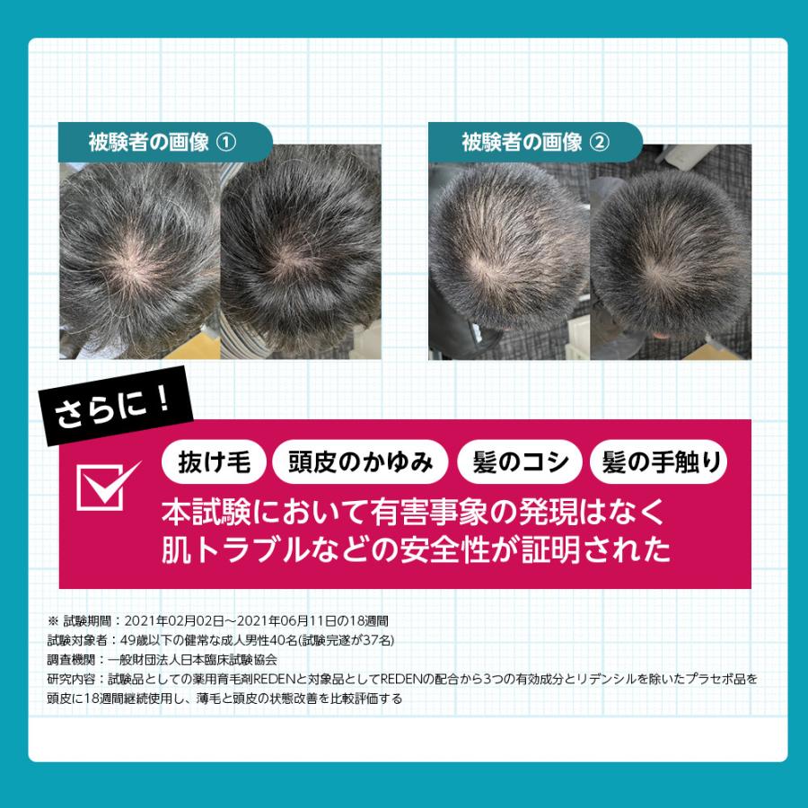 育毛剤 シャンプー セット REDEN ヘアケアセット 育毛剤 薬用シャンプー スカルプケア 薬用育毛剤 スカルプシャンプー 医薬部外品 育毛 頭皮ケア 薄毛対策｜reden｜09