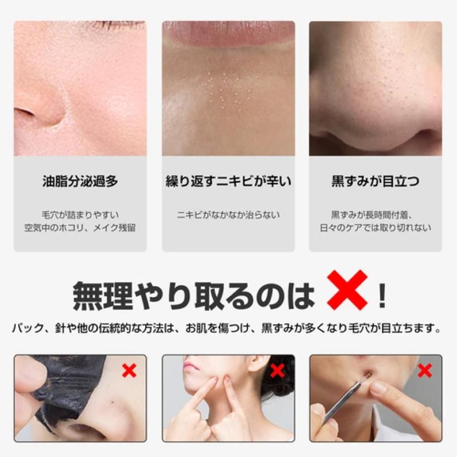 Miss Veil　ミスヴェール　角質取り　毛穴吸引　美顔器 Miss Veil ミスヴェール 角質取り 毛穴吸引 美顔器 Miss Veil