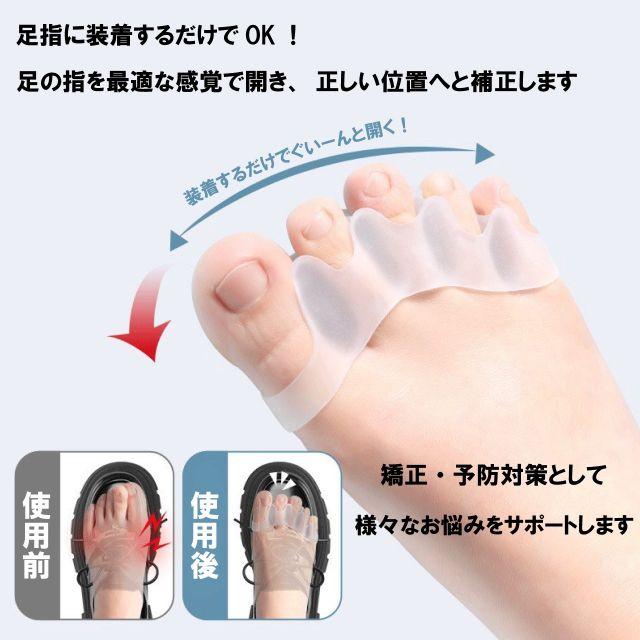 種類1：1セット/ベージュ 足指セパレーター 足指 広げる グッズ