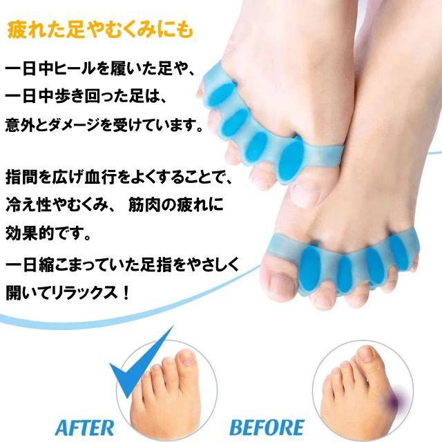 種類1：1セット/ベージュ 足指セパレーター 足指 広げる グッズ