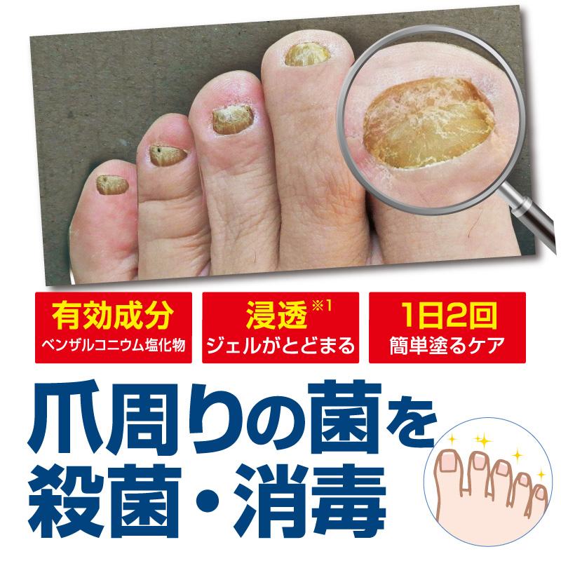 薬用 ツメキラリ２本組 指定医薬部外品 薬用ジェル つめ 殺菌 消毒 薬用 爪 きらり 薬用ジェル 足の爪 足 爪 変色 爪周りケア ボロボロツメ |  | 01