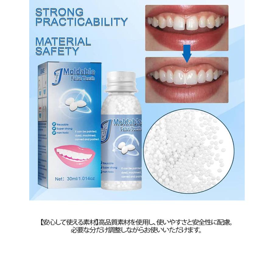 差し歯 接着 剤