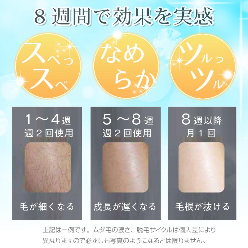 Ipl脱毛器 光脱毛器 Hikari 家庭用脱毛器 Vio対応 冷却 全身脱毛 100万発 保護メガネ付 シェーバー付 レーザー脱毛器 永久脱毛 最新版 1年保証 無痛 Bs 003 01 医療用ウィッグかつらライツフォル 通販 Yahoo ショッピング