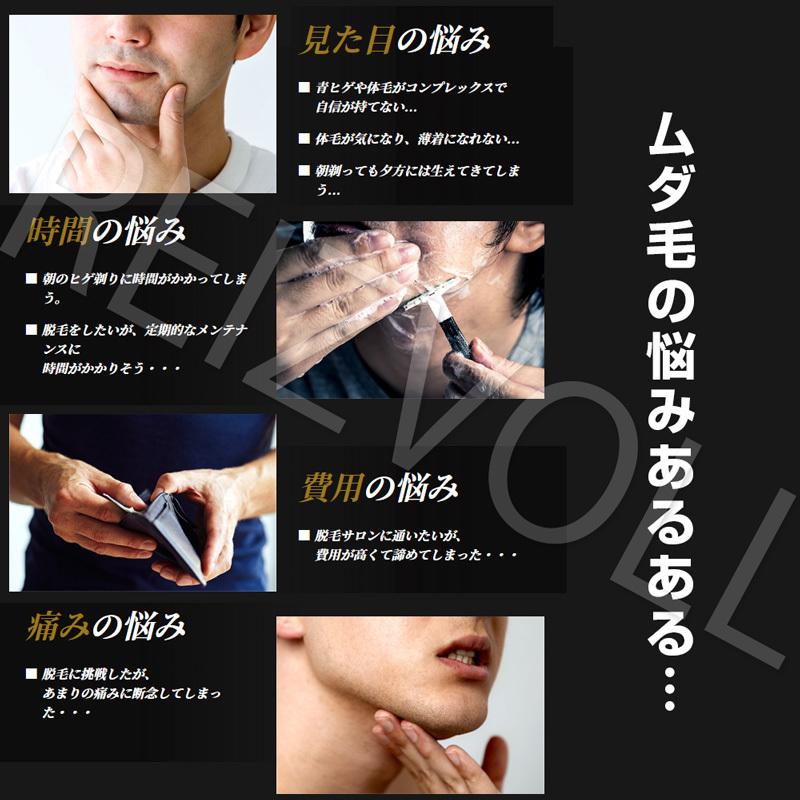 IPL光脱毛器 1年保証 痛くないハイパワー家庭用全身脱毛機で自宅 IPL光脱毛器 1年保証 痛くないハイパワー家庭用全身脱毛機で自宅