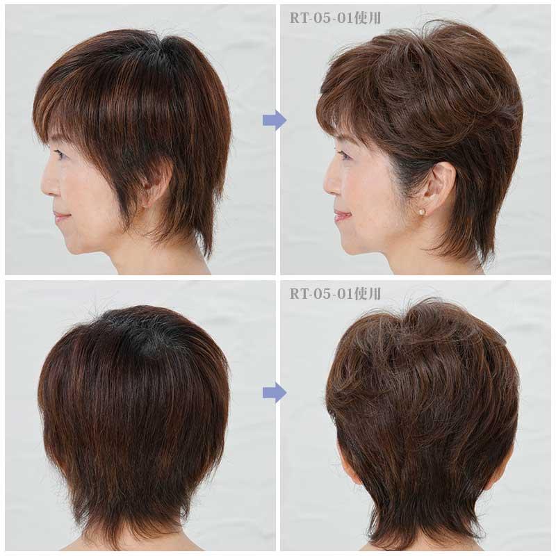 頭頂部部分ウィッグ RT05-01 人毛MIX高級かつら 人工肌 トップ ヘアピース ツーペ メンズ レディース 女性 男性 つむじの薄毛 前髪や分け目の白髪隠し ツーペ メンズ レディース 女性 男性 頭頂部