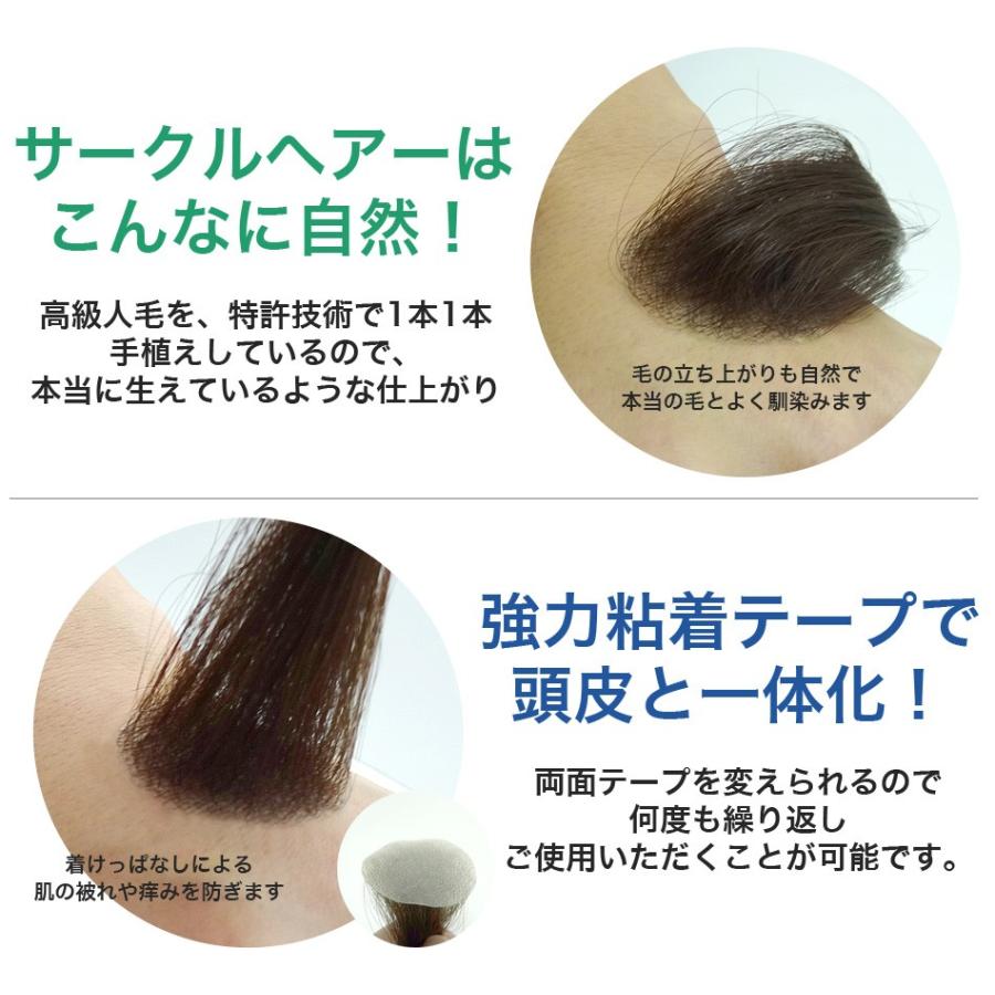 円形脱毛用かつらシート サークルヘアー MR-01 直径40mm テープ 円形脱毛用かつらシート サークルヘアー MR-01 直径40mm テープ