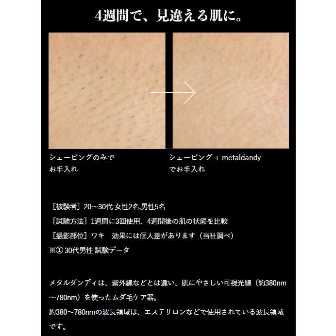 メタルダンディ アイスダンディ 刺青 脱毛器 Notime Icedandy