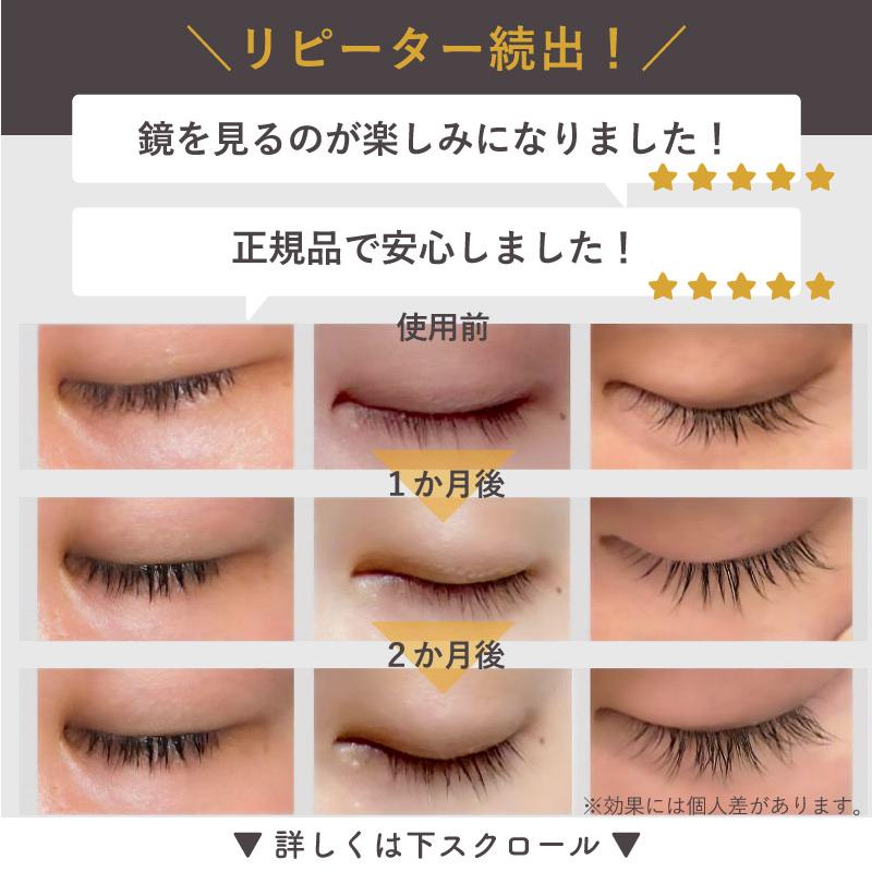 Lash addict & EYELASH LIPOZONE 正規品 正規品】 まつ毛美容液 ラッシュアディクト 正規 アドバンス アイ