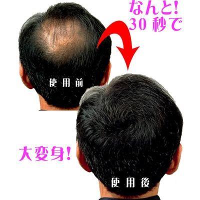 ウェルシークレットg 4個セット 薄毛カバー 髪ボリューム 円形脱毛症 A0905 り びショップ Yahoo 店 通販 Yahoo ショッピング