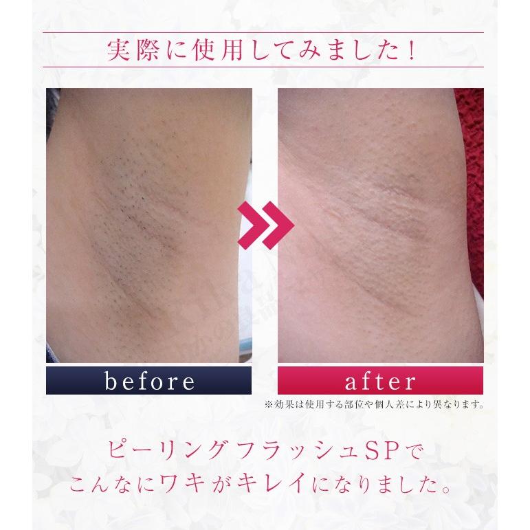 オムニ ピーリングフラッシュSP ピーリング シェーバー 女性用 ボディ