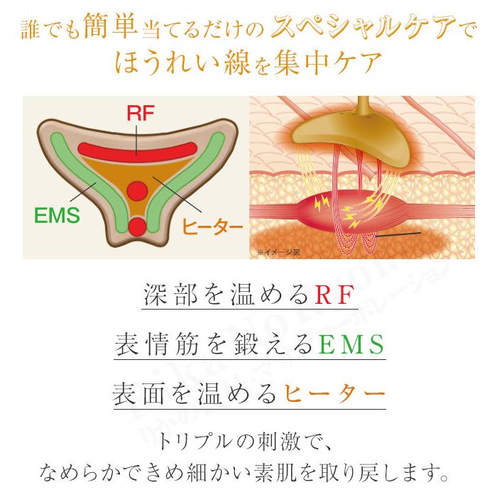 ほうれい線アイロン ナソラヴィアルフォールドES シャンパンゴールド YMO-… Amazon.co.jp: ほうれい線アイロン ナソラビアルフォールド YMO