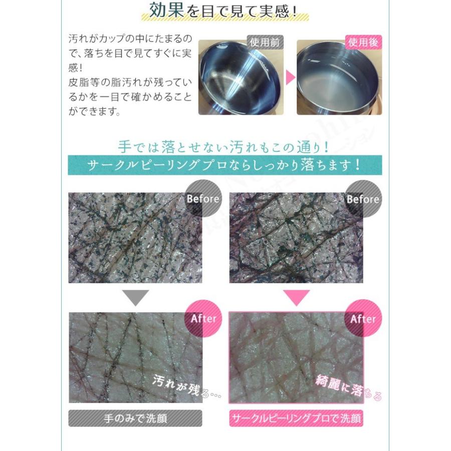 サークルピーリングプロ HDS-30N ヤーマン 毛穴ソニック美顔器