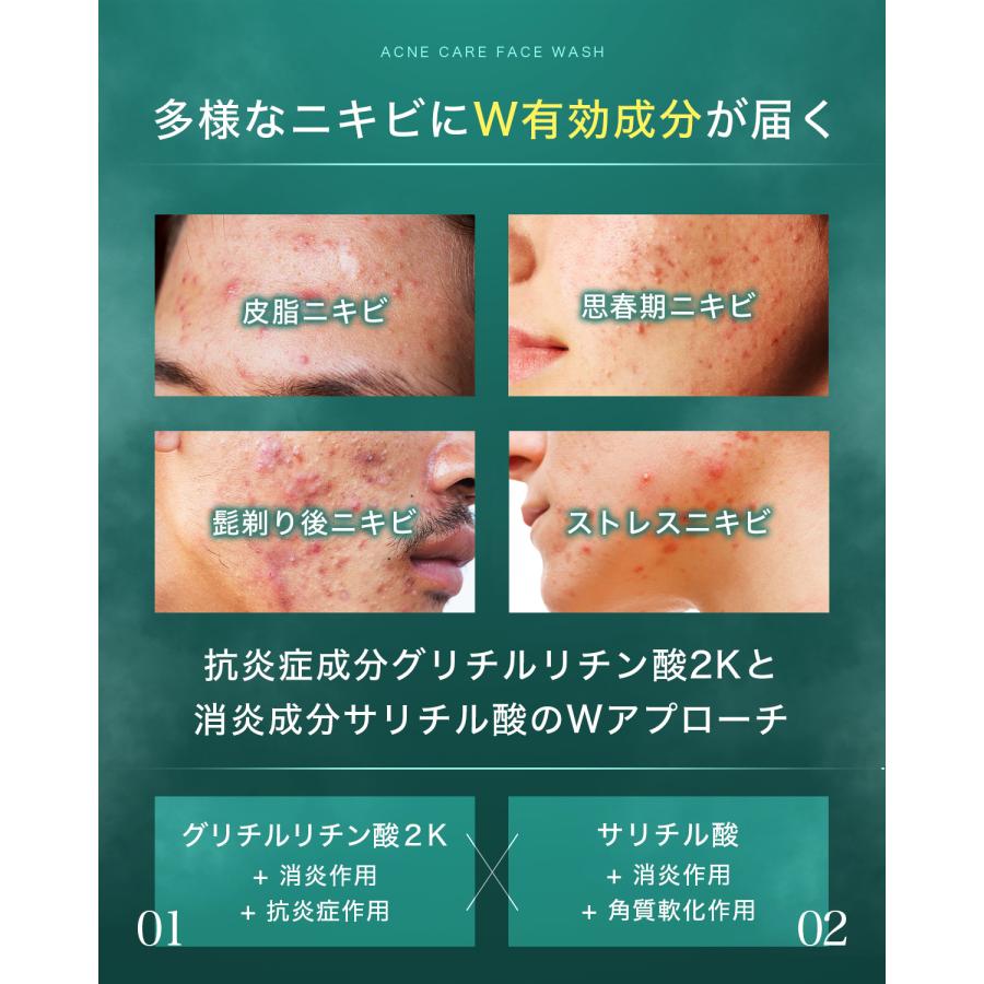 Nile ニキビケアセット 3点セット or 4点セット ニキビ洗顔 ニキビ化粧
