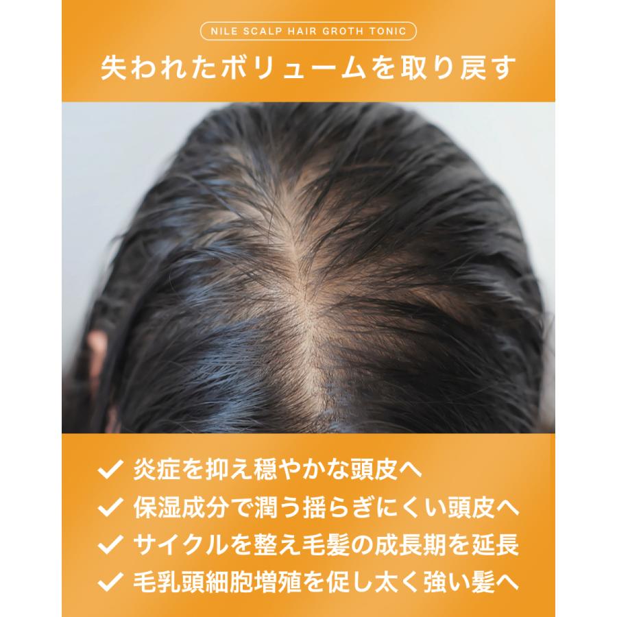 NILE 育毛剤 レディース 女性用  育毛トニック スカルプヘアローション 頭皮ケア 医薬部外品150ml | Nile（コスメ） | 04