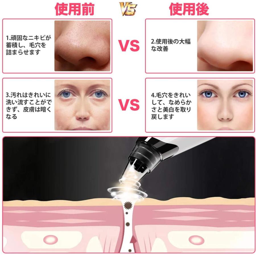 【2021最新版】毛穴吸引器 美顔器 5種類の吸引ノズル 5段階吸引力 ニキビ 2021最新 毛穴吸引器 美顔器 美容機 5種類の吸引ヘッド 3階段