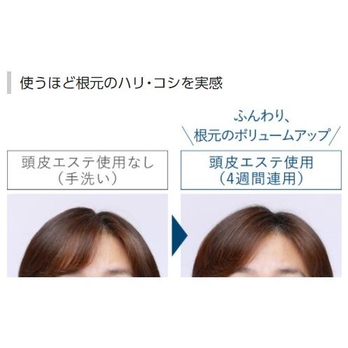 Panasonic（パナソニック） EH-HE0G-T 頭皮エステ サロンタッチタイプ