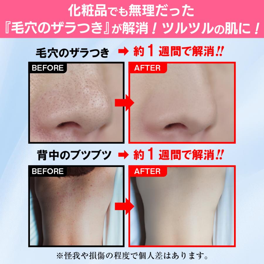 お試し 30％OFF】あかすり 日本製 シルク100％ 絹垢すり 黒ずみ解消