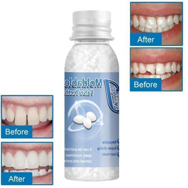 歯の修復ツール 一時的 入れ歯 成形可能 固形接着剤 仮歯 義歯 隙間入れ 樹脂ビーズ｜romistore33｜02