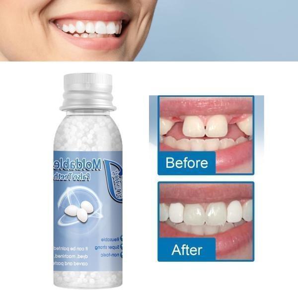 歯の修復ツール 一時的 入れ歯 成形可能 固形接着剤 仮歯 義歯 隙間入れ 樹脂ビーズ｜romistore33｜04
