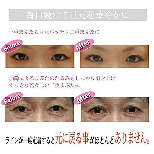 大きな割引 二重 二重まぶた埋没法 グッズ くせ付け 二重まぶた 寝る前 二 中学生 アイプチ 美顔器 引き締め 引き上げ 二重 まぶた 強力 器具 癖付け 形成 強力粉 Www Raveby Com