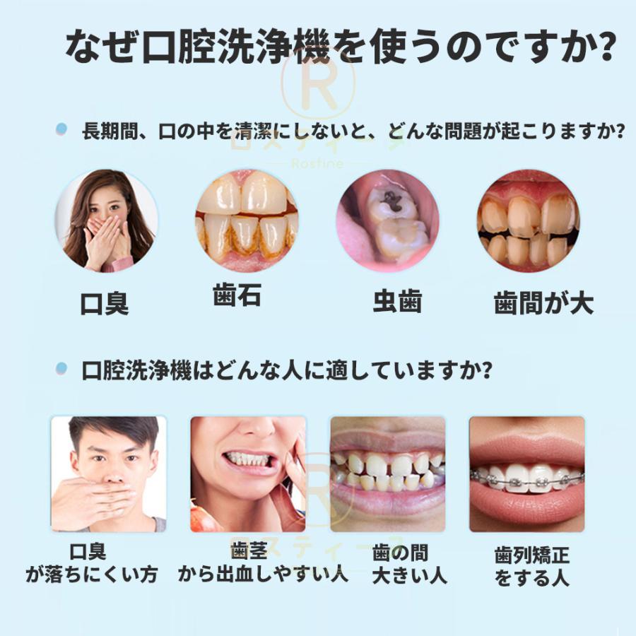 即納 口腔洗浄器 歯垢除去 口内洗浄機 超音波 ジェットウォッシャー 電動 usb充電式 歯磨き 歯周病予防 スペシャルセット 口臭防止 母の日 プレゼント 1年保証｜rostine｜03