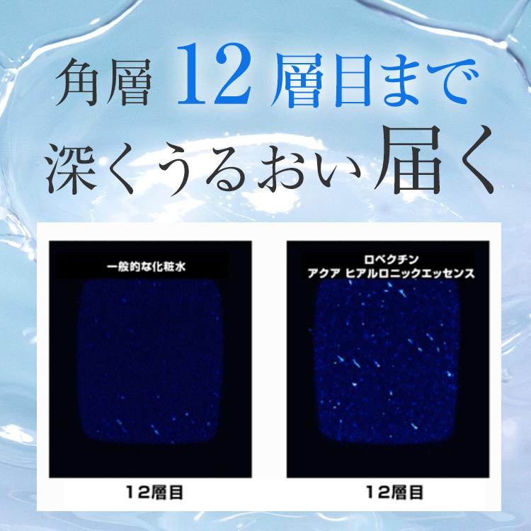 化粧水 スキンケア、フェイスケア化粧水 保湿 高保湿 敏感肌 メンズ レディース ロベクチン日本公式 アクアヒアルロニックエッセンス100mL | ブランド登録なし | 02