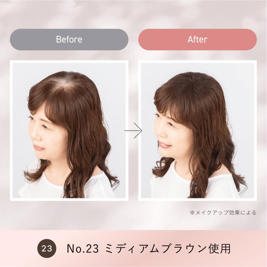 スーパーミリオンヘアー レディースセット 10g+スプレー35g ルアン