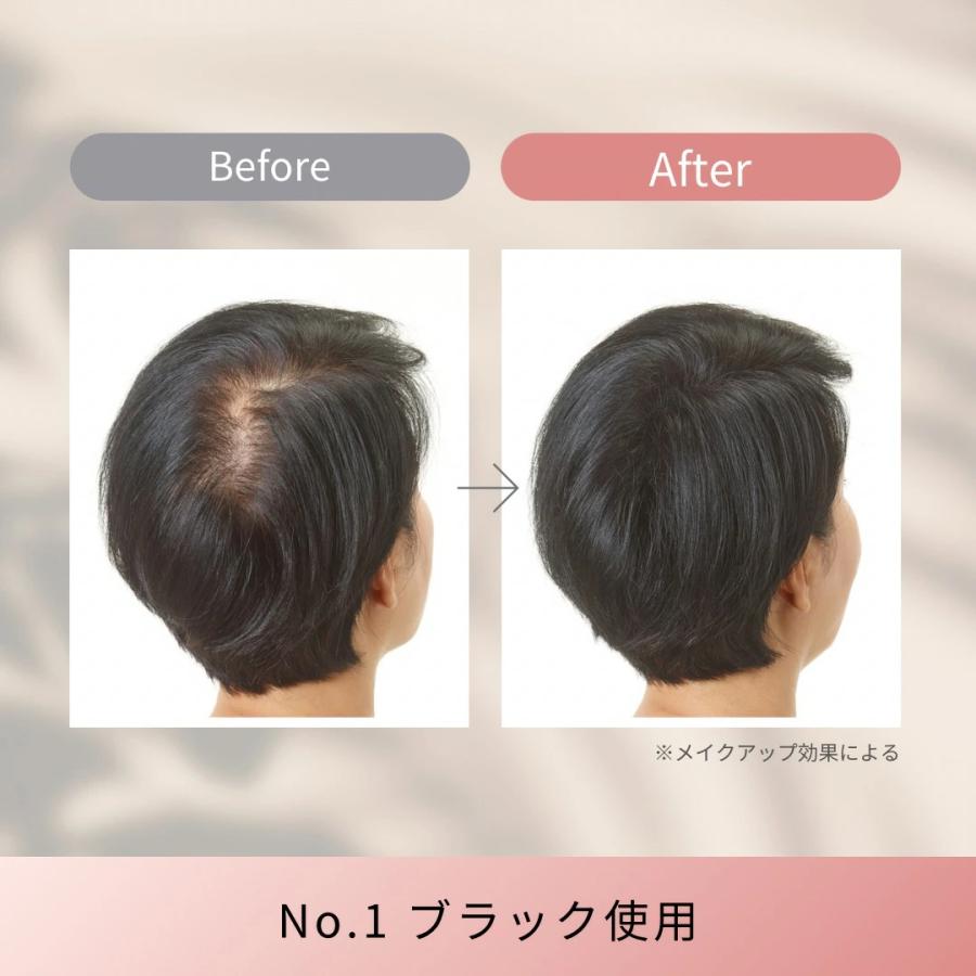 スーパーミリオンヘアー レディースセット 10g+スプレー35g ルアン