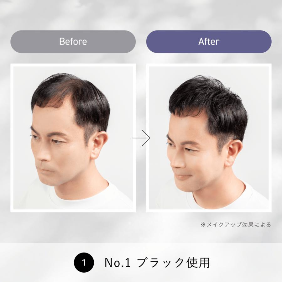 スーパーミリオンヘアー コンパクトセット 10g+15mL ルアン 公式 薄毛