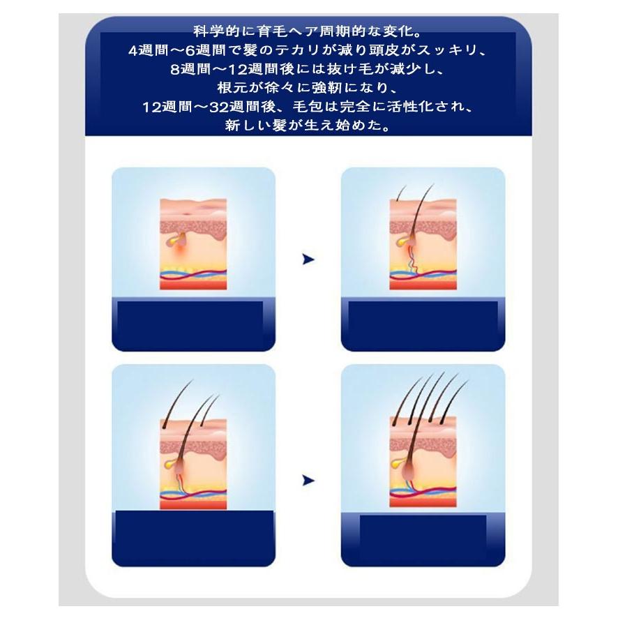 育毛キャップ 育毛ヘルメット 発毛促進 赤外線光治療キャップ 発毛
