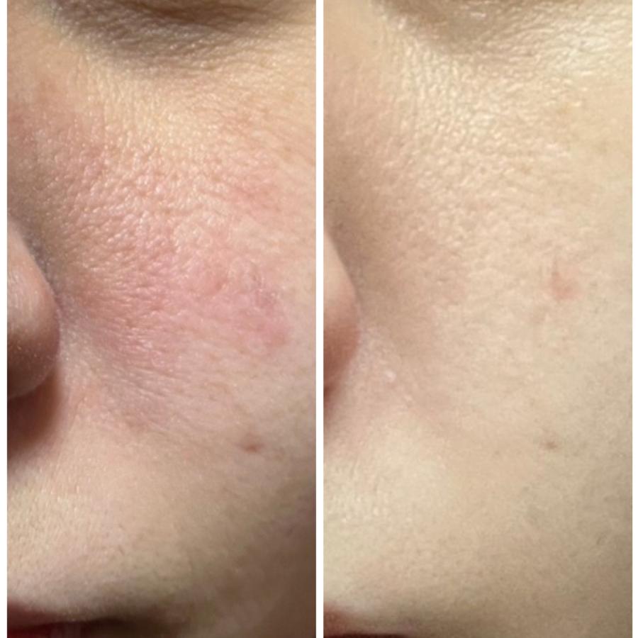 鉱石とＮＭＮのコラボ Runa ほるみん 25ｇとＮＭＮ配合 ほるみすと   アロマ デトックス リンパ 美肌  岩盤浴 |  | 04