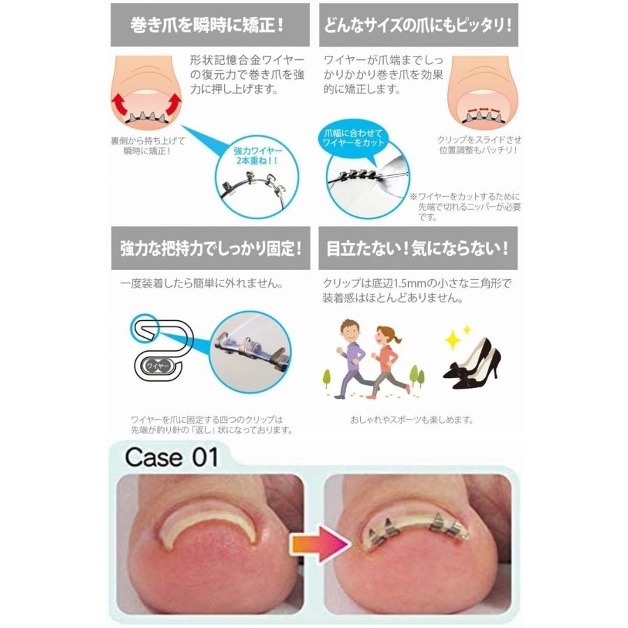 まきづめリフト ヤスリ付 《4本爪、巻き爪 矯正 ワイヤー