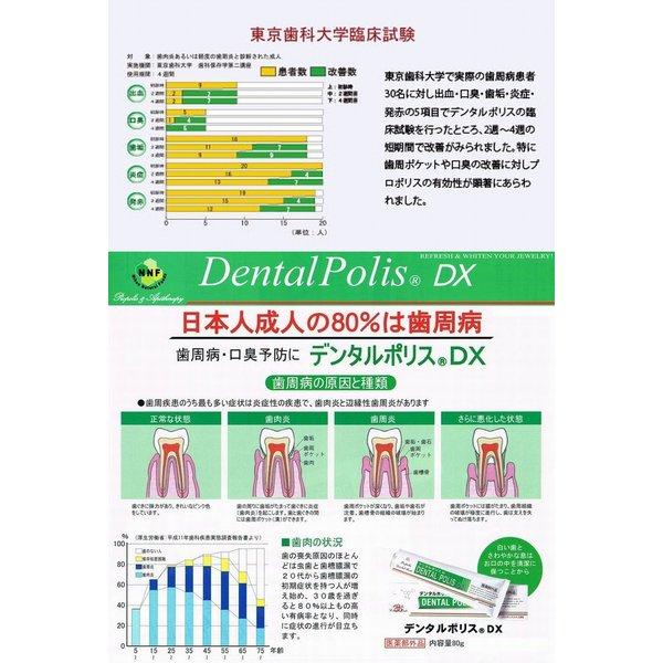 デンタルポリス ｄｘ ６本で送料無料 ８０ｇ 医薬部外品 歯肉炎 歯槽膿漏 口臭を予防 ル リアン 通販 Yahoo ショッピング