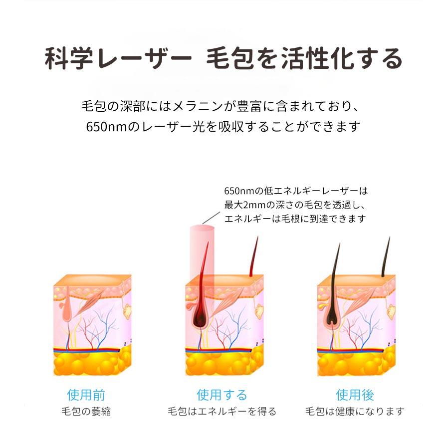 育毛ヘルメット 治療ライト 赤色 led 育毛 頭皮 レーザー育毛ヘルメットLED赤色光 脱毛 薄毛治療 男女共用 副作用のないヘ髪の再生 赤色光のより厚い現像｜ryouhinsya｜04