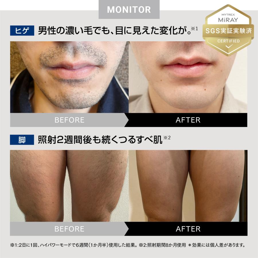 MYTREX（マイトレックス） 公式 MiRAY 脱毛器 メンズ IPL DPL ムダ毛
