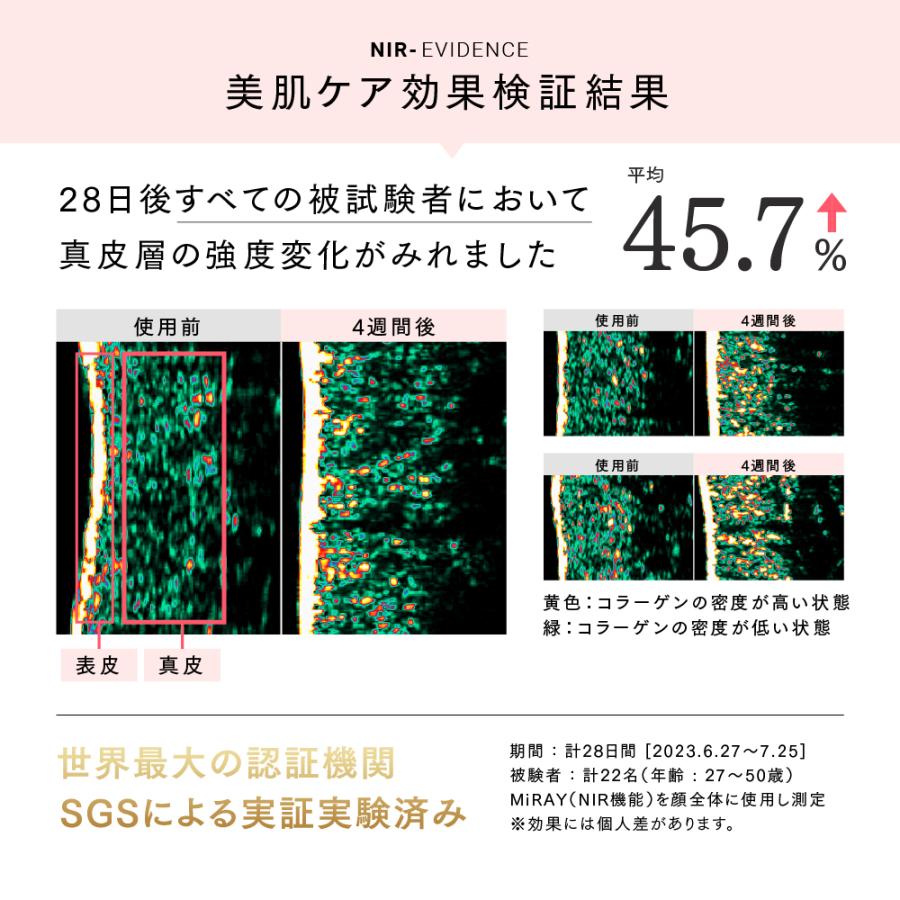 MYTREX 公式 MiRAY 専用 NIR リフト アタッチメント Near MYTREX 公式 MiRAY 専用 NIR リフト アタッチメント Near