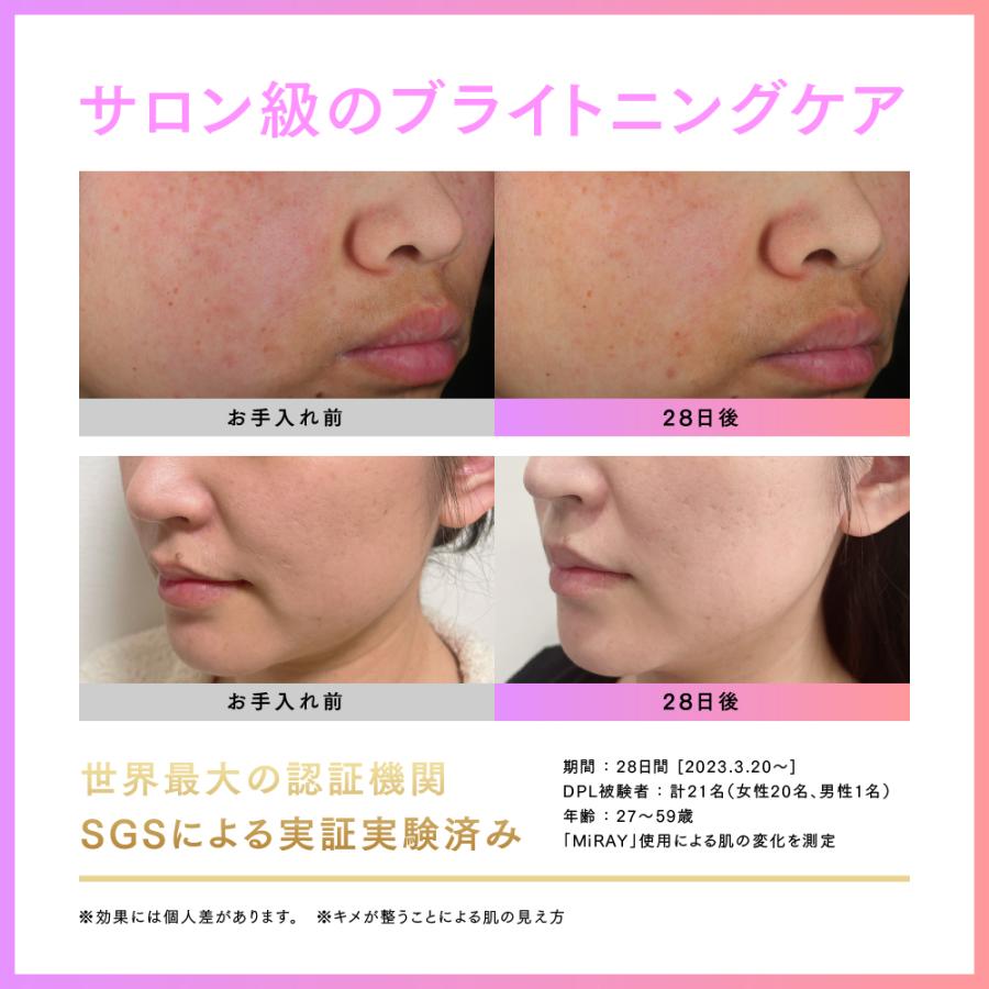 83％以上節約MYTREX MiRAY マイトレックス ムダ毛ケア 光美容器 ミライ