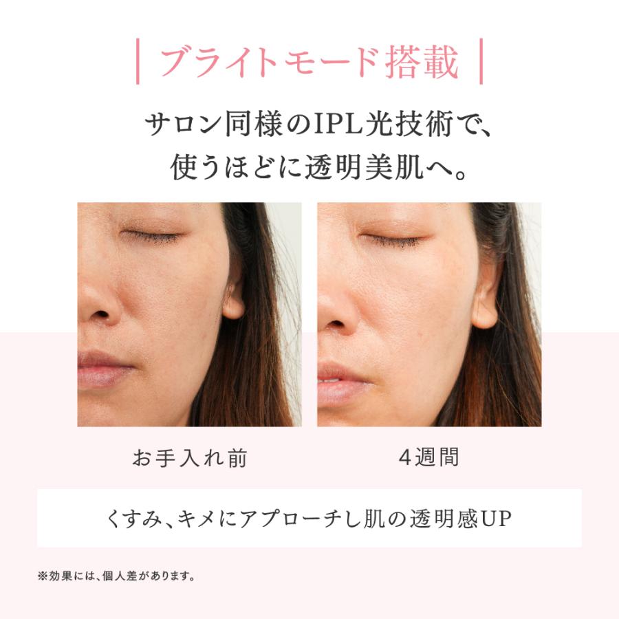 MYTREX 脱毛器 公式 MiRAY AIR 光美容器 ムダ毛ケア 脱毛機 光 MYTREX 脱毛器 公式 MiRAY AIR 光美容器 ムダ毛ケア 脱毛機 光