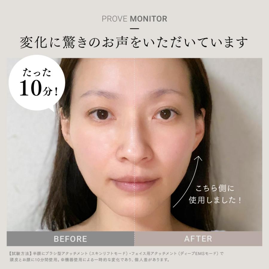 MYTREX 【30日間返品保証】美顔器 EMS 公式 PROVE 美容家電 電気 MYTREX 【30日間返品保証】美顔器 EMS 公式 PROVE 美容家電 電気