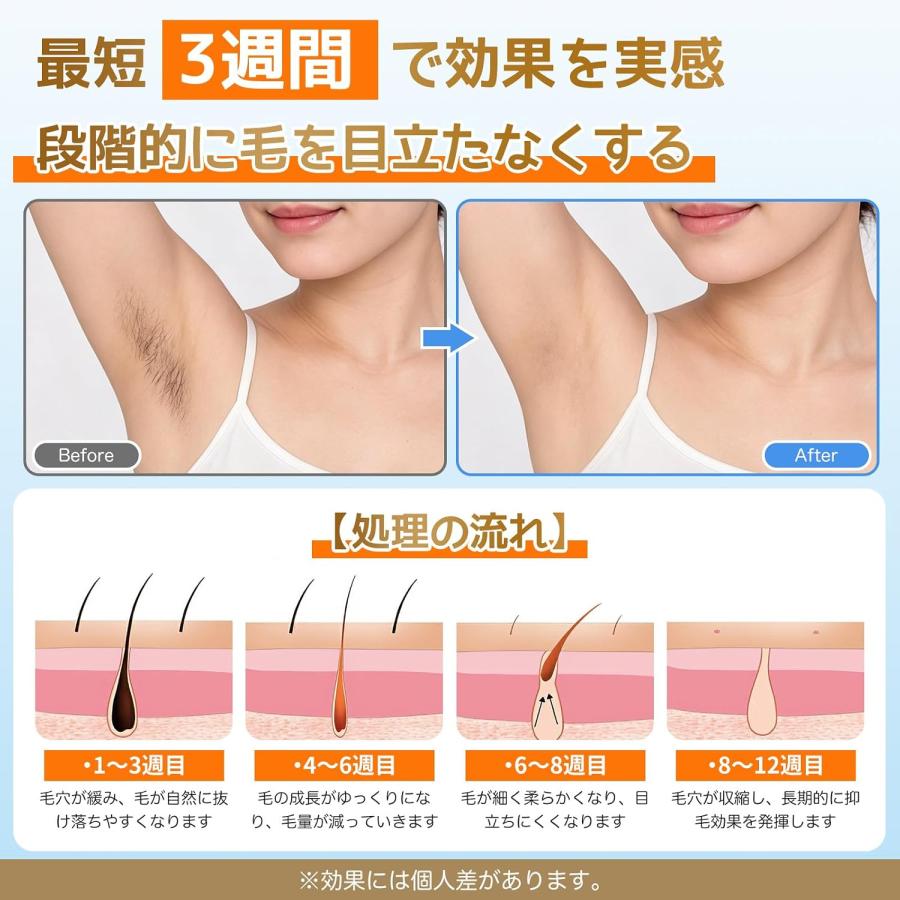 脱毛器 IPL 光美容器 サファイア冷却 5℃ 冷感 VIO対応 メンズ