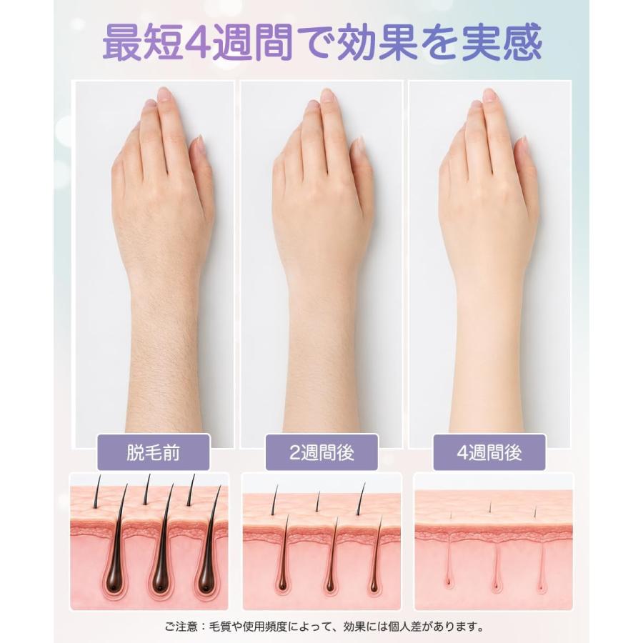 脱毛器 IPL 光美容器 サファイア冷却 15.58J 冷感 VIO対応 メンズ
