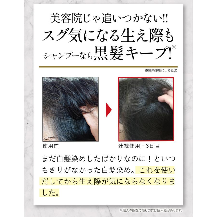 1本7役 白髪染め トリートメント シャンプー コンディショナー ダメージケア 頭皮ケア 色持ちサポート バランローズ Kuroクリームシャンプー 400g Valanrose公式 Yahoo 店 通販 Yahoo ショッピング