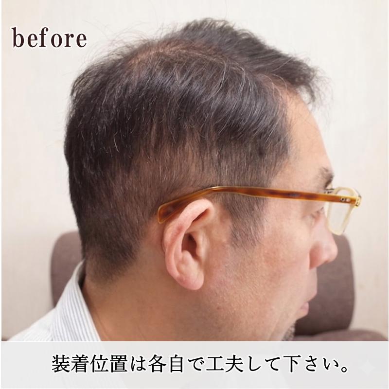 さくら倶楽部 男性用メンズ部分ウィッグ人毛100% top-01t Sサイズ 総