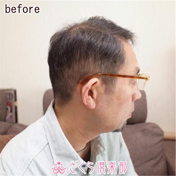 さくら倶楽部 部分ウィッグ メンズ 男性用かつら 人毛100％ Sサイズ